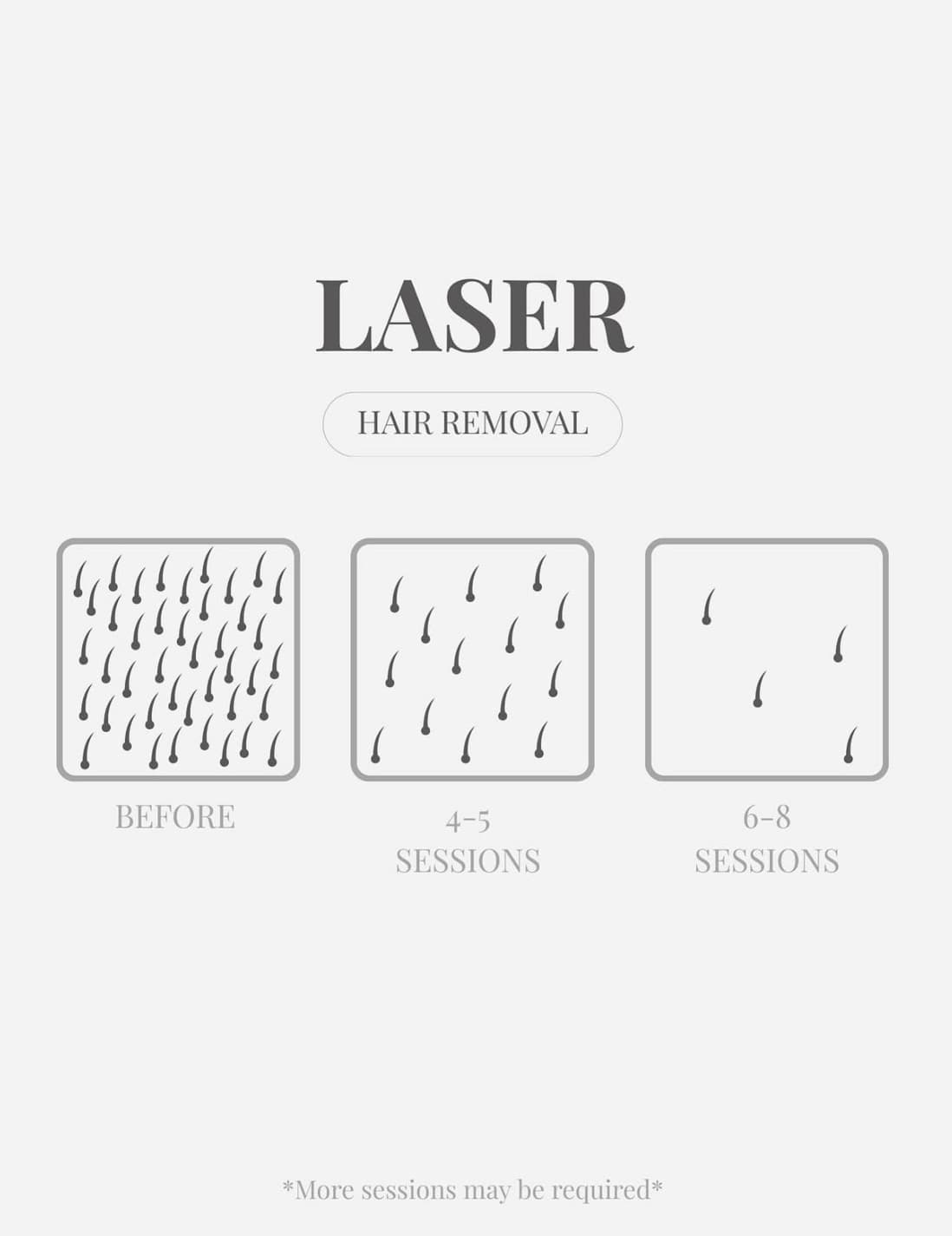 Illustration showing progressive hair reduction across a course of laser sessions